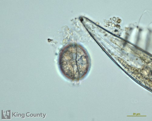Photo of Diplopsalid dinoflagellates